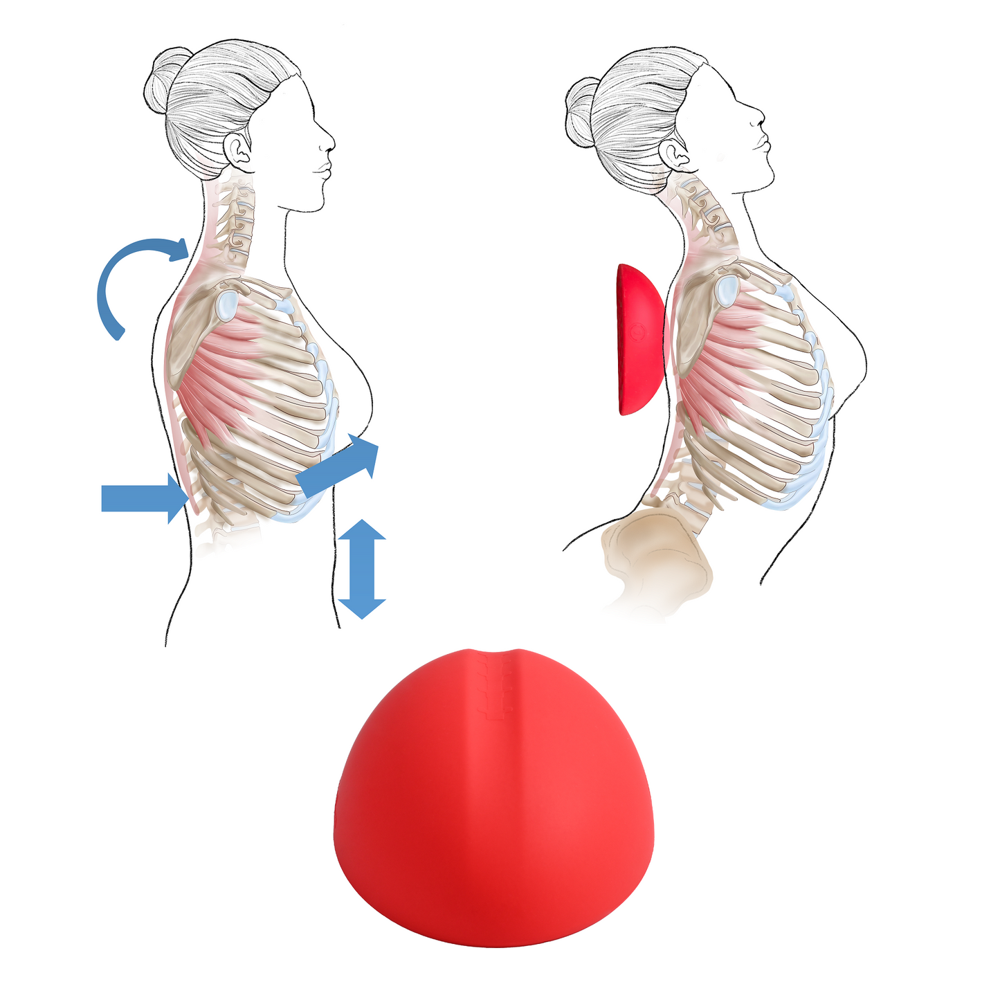 TOS Pain Relief