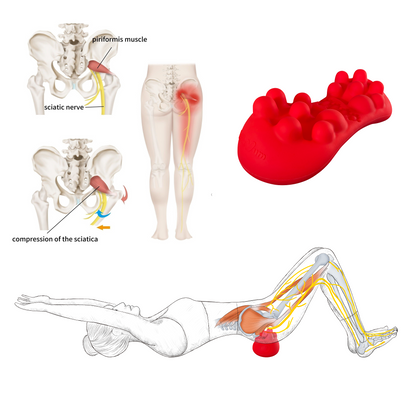 Sciatica Pain Relief