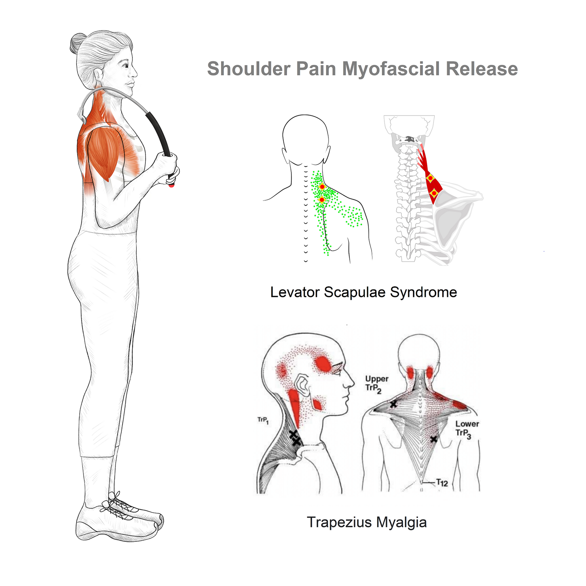Levator Scapulae Syndrome Relief