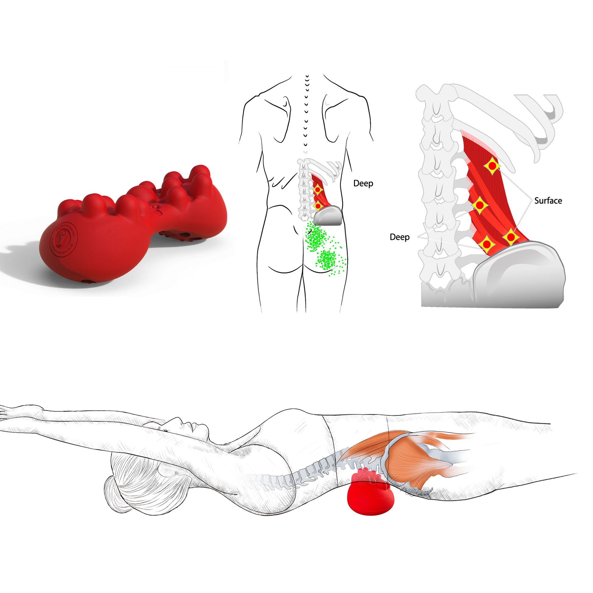 Quadratus Lumborum Trigger Point Release