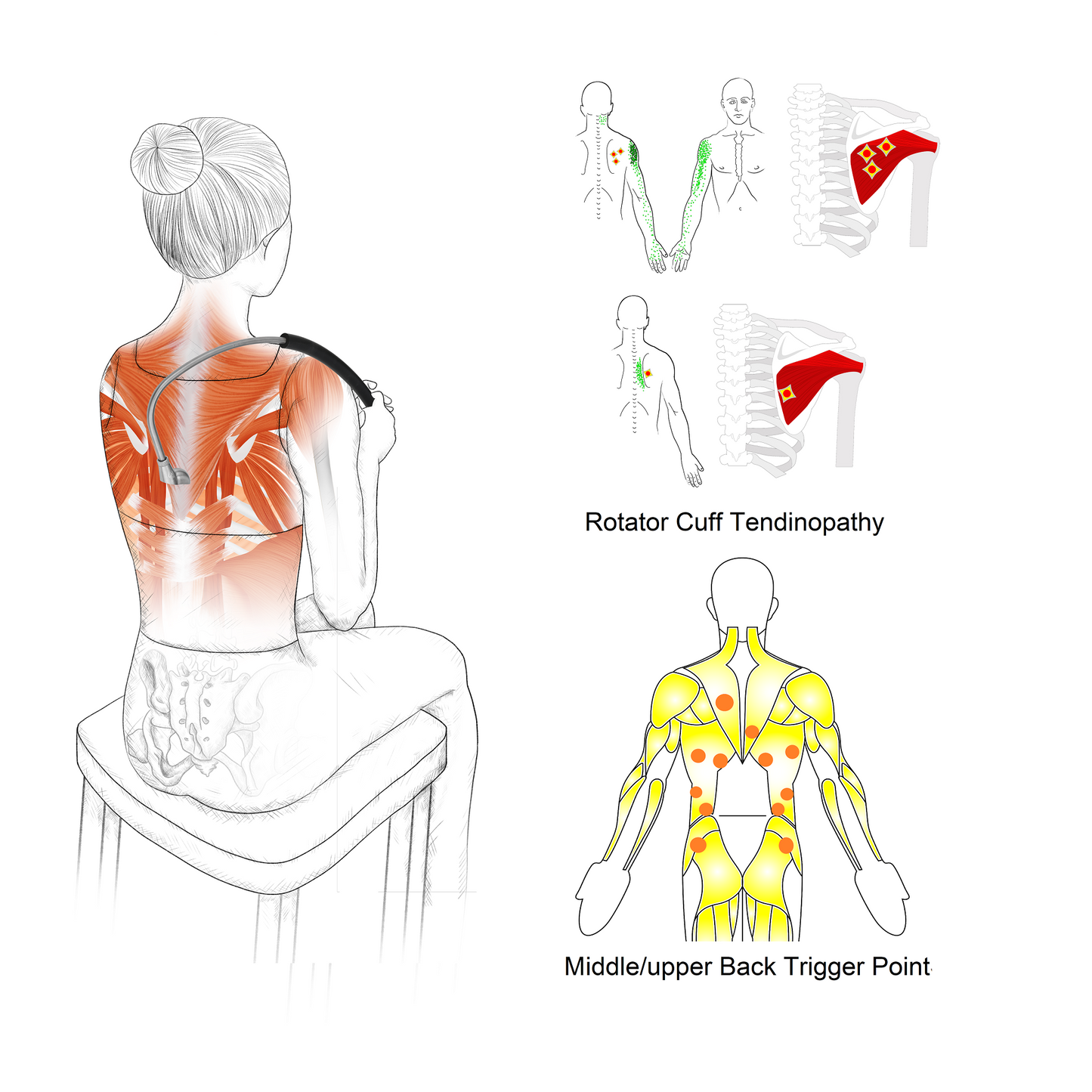Shoulder Blade Pain Release