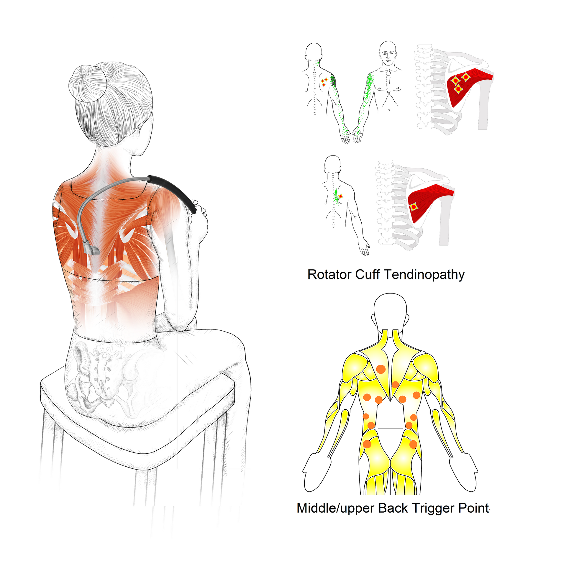 Shoulder Blade Pain Release