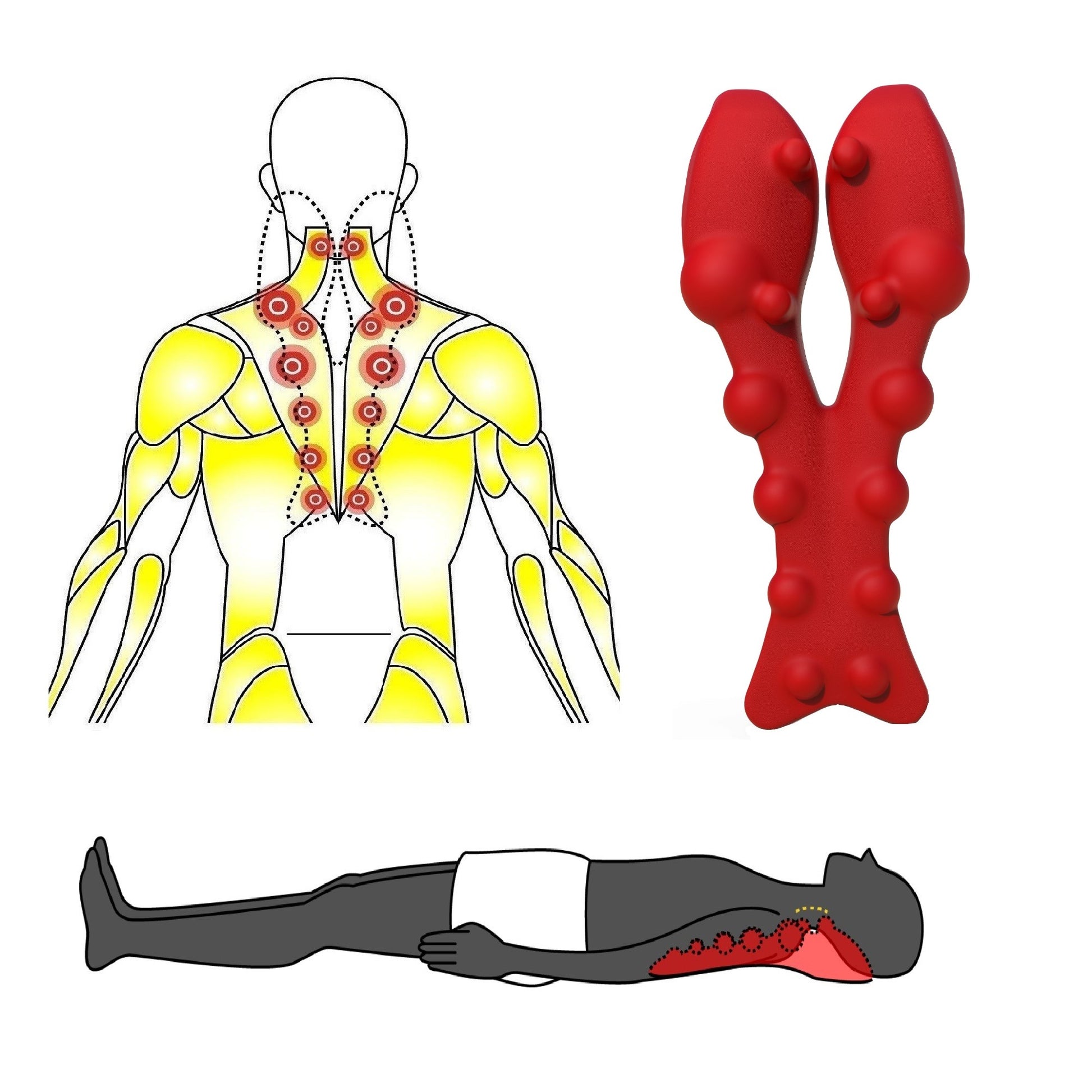 How to Self-Massage Your Trapezius Muscle? What causes trapezius muscle knots? Poor cervical (neck) neck positioning and posture that shift your head's load forward cause inefficient loading to the cervical spine and put additional strain on the muscles at the back of your neck, including your trapezius. This is so much more common now with the ubiquitous use of cell phones