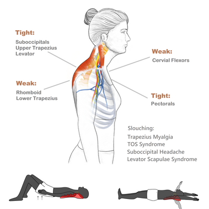 How to Correct Poor Posture 